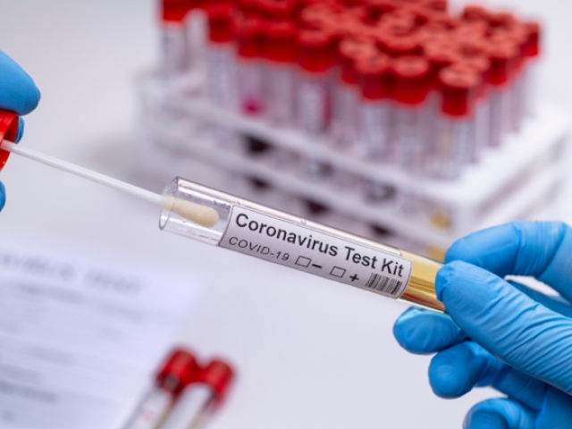 How might men with a history of COVID-19 infection be affected sexually?