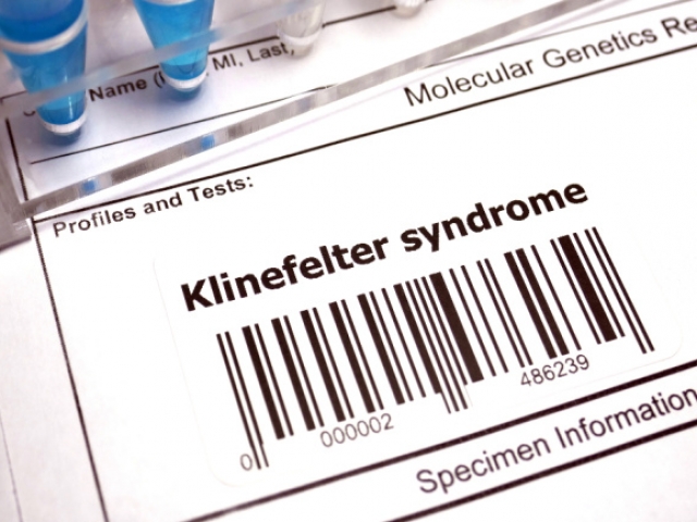 What is Klinefelter Syndrome? How might it affect sexual health?