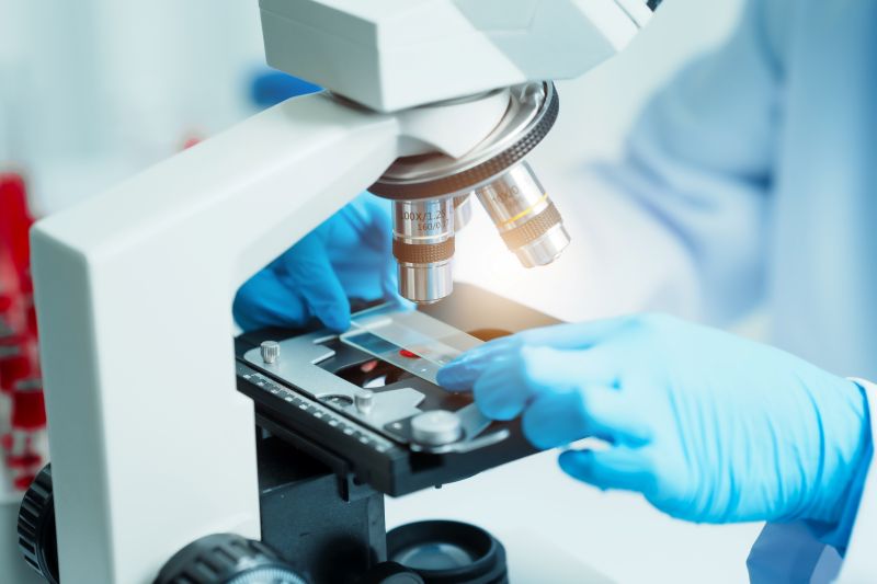 Blood sample on microscope stage