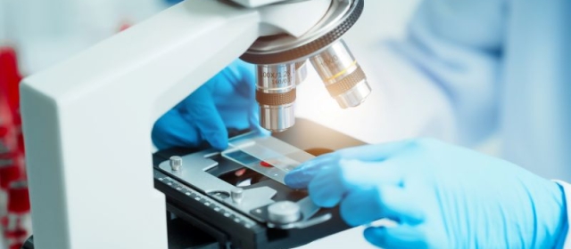 Blood sample on microscope stage