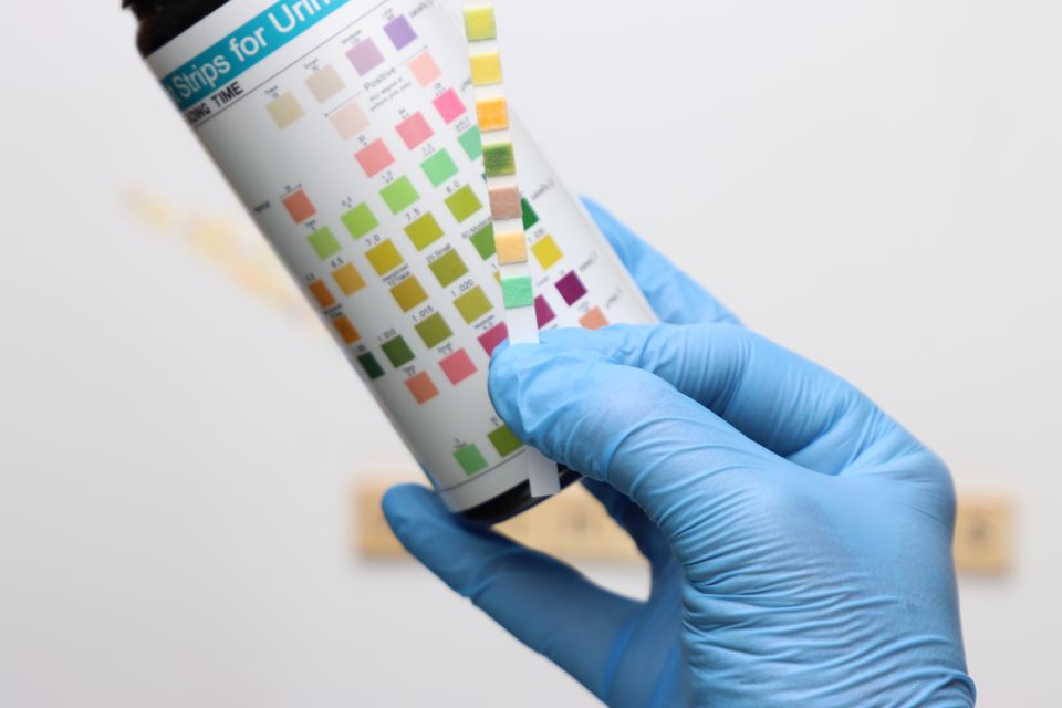 urine sample strip