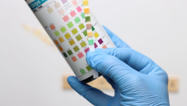 urine sample strip