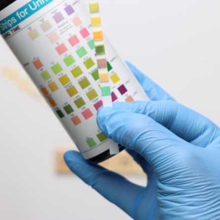 urine sample strip